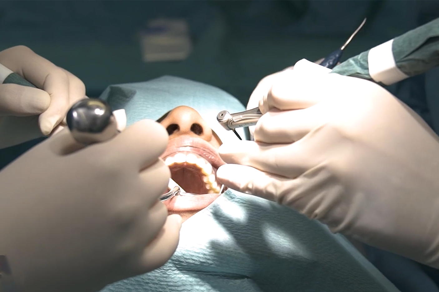 Implantologie 2 – Chirurgie: vom einfachen zum komplexen Fall, Hygiene und steriles Arbeiten