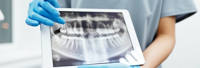 Die allgemeinmedizinische Anamnese in der Zahnarztpraxis
