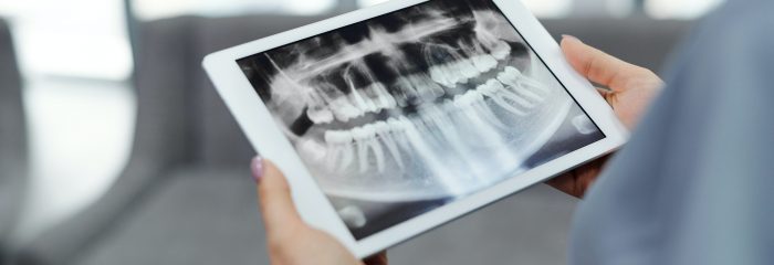 Zahnärztliches Röntgen