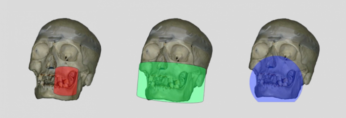 Die dentale digitale Volumentomographie