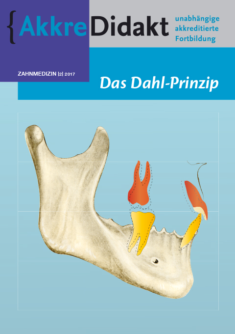 Das Dahl-Prinzip