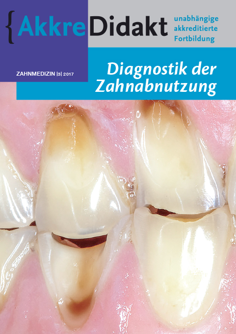 Diagnostik der Zahnabnutzung