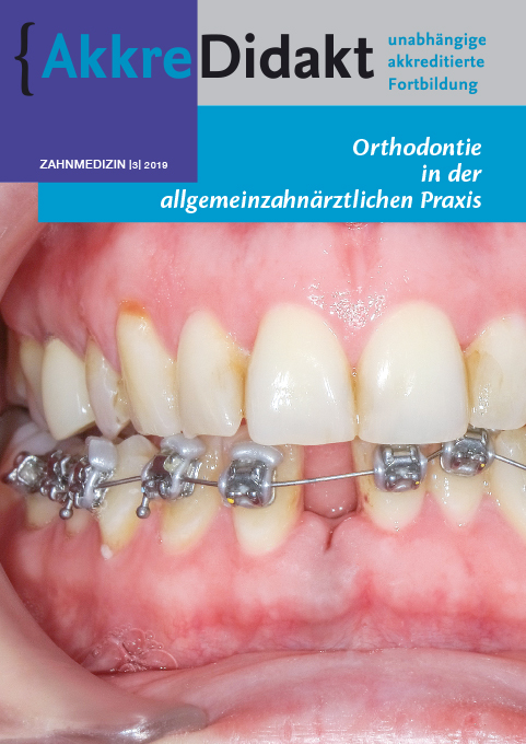 Orthodontie in der allgemeinzahnärztlichen Praxis